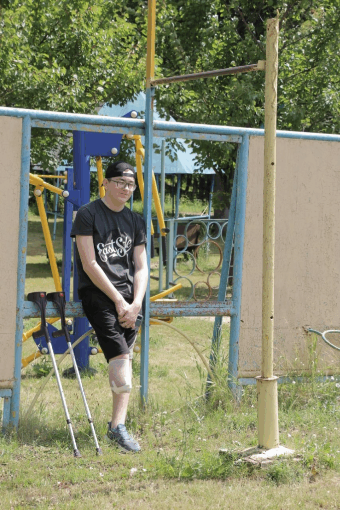Ivan, with the lower part of his right leg missing, leans against a blue and yellow playground structure, with crutches resting nearby, wearing a black t-shirt, shorts, glasses, and a backwards cap, in a grassy outdoor area surrounded by trees.