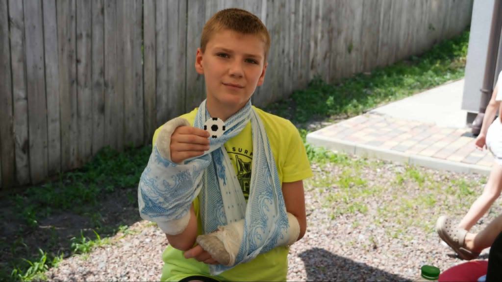 Young boy with both arms in plaster casts holding a small handmade football decoration while sitting outdoors.